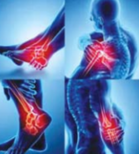 हाडांची झीज थांबवण्यासाठी व्यायाम करा